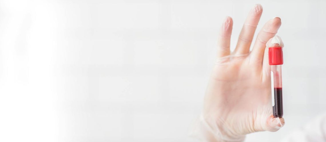 Adrenochrome : l’histoire d’un mythe glaçant Adrenochrome : l'histoire d'un mythe glaçant